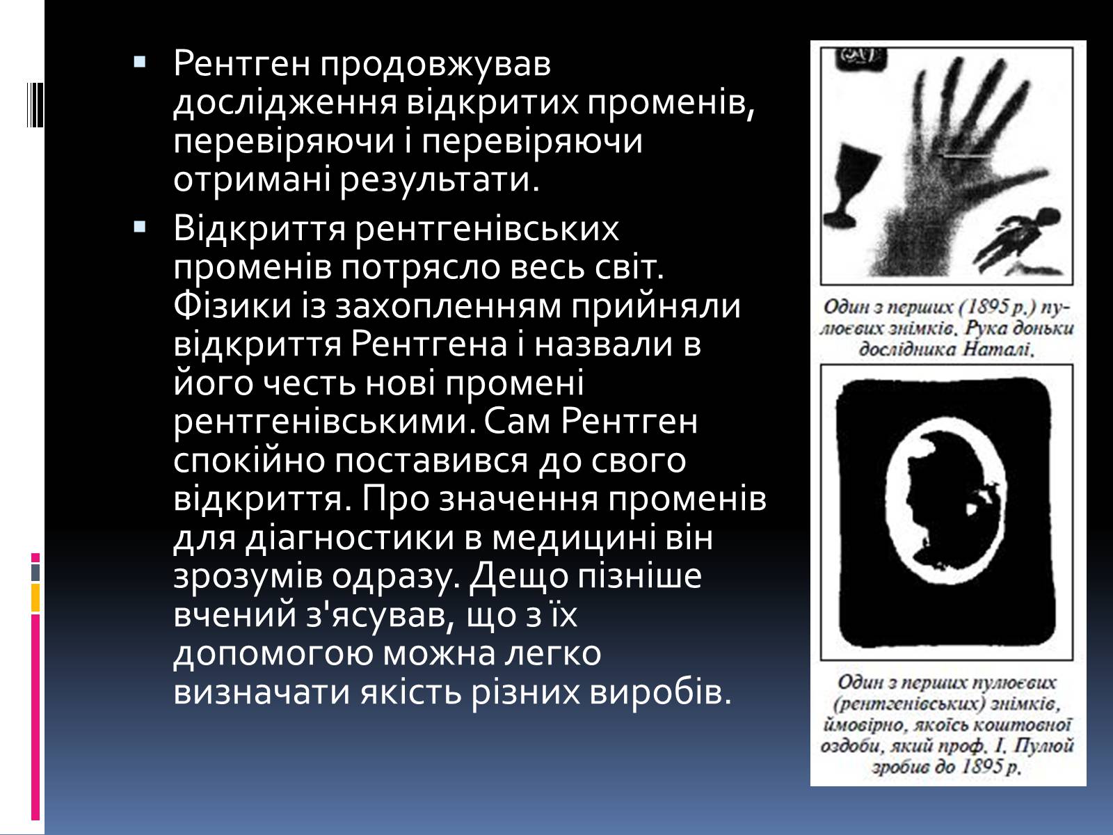 Презентація на тему «Рентгенівське випромінювання» (варіант 1) - Слайд #5