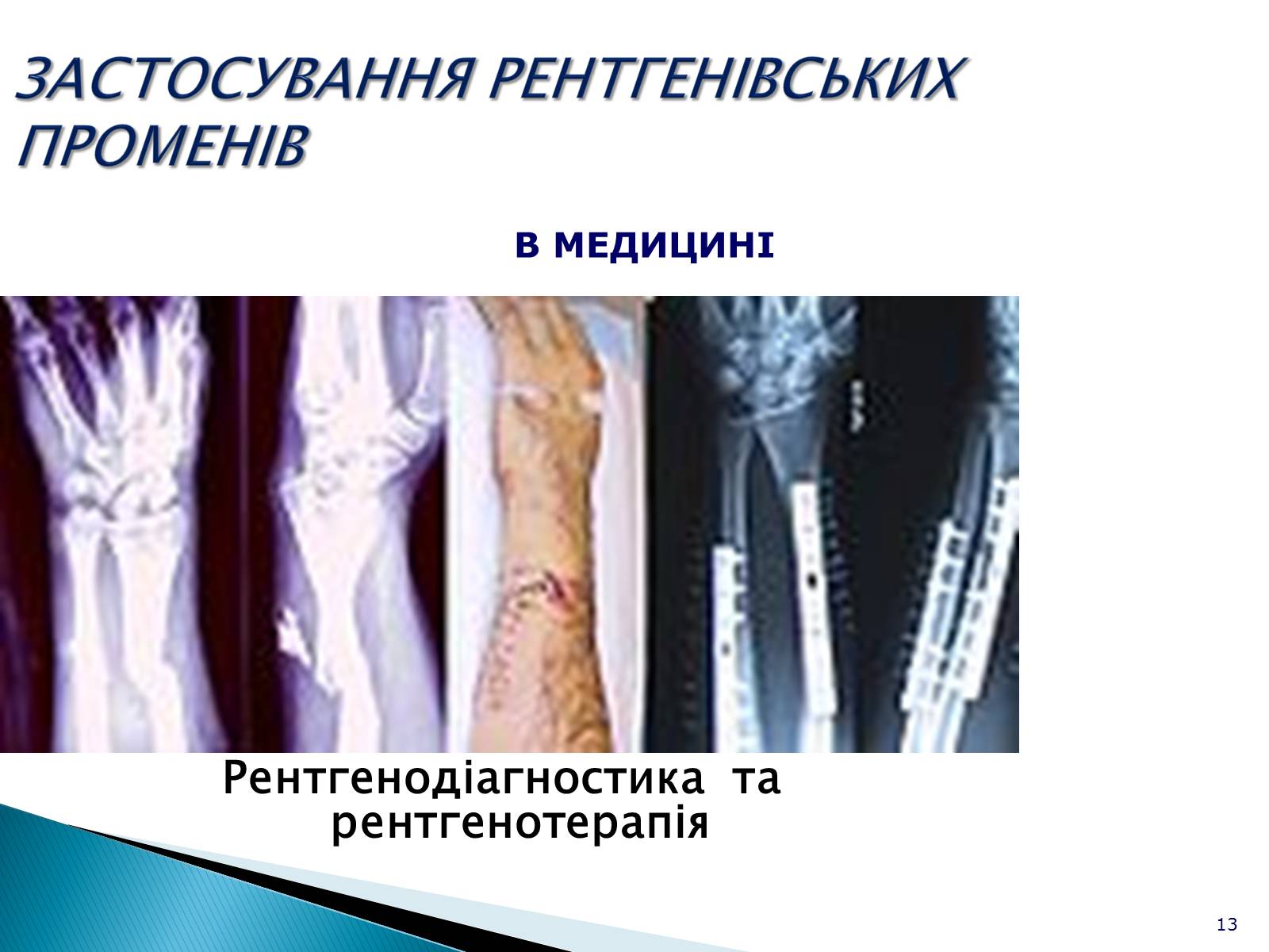 Презентація на тему «Рентгенівське випромінювання» (варіант 5) - Слайд #13