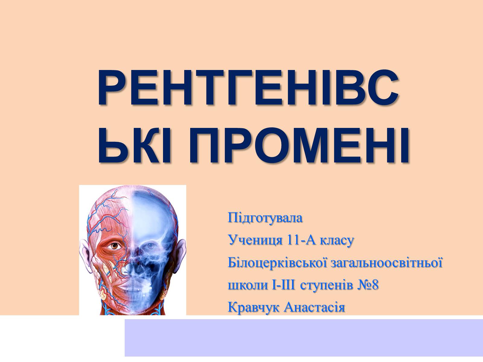 Презентація на тему «Рентгенівські промені» - Слайд #1