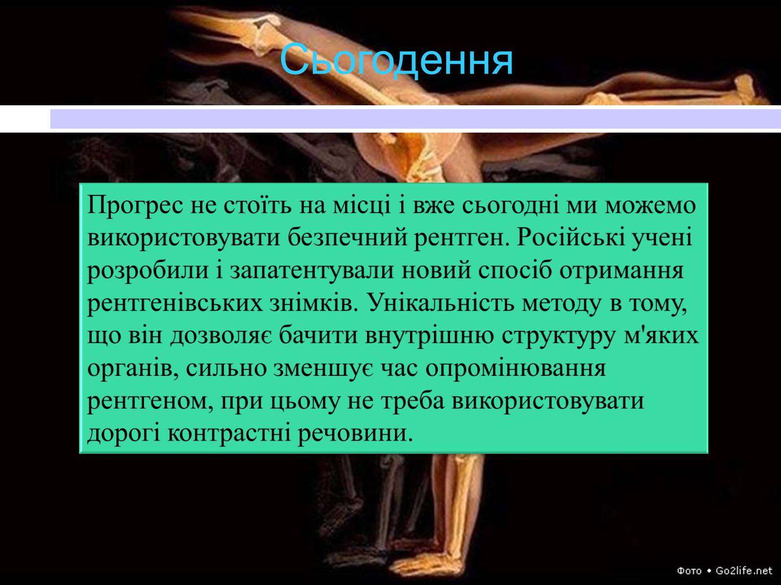 Презентація на тему «Рентгенівські промені» - Слайд #21