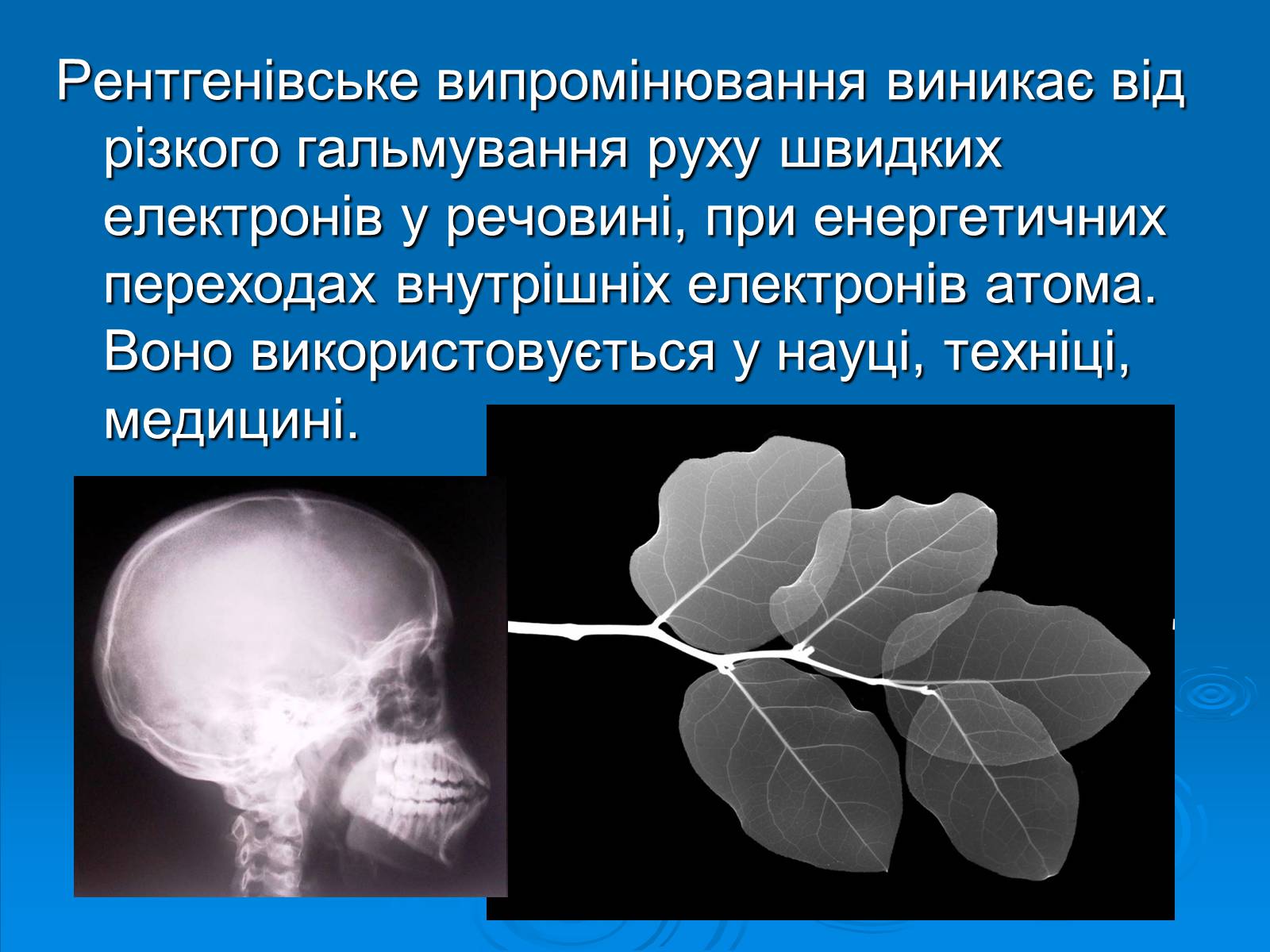 Презентація на тему «Рентгенівське випромінювання» (варіант 10) - Слайд #3