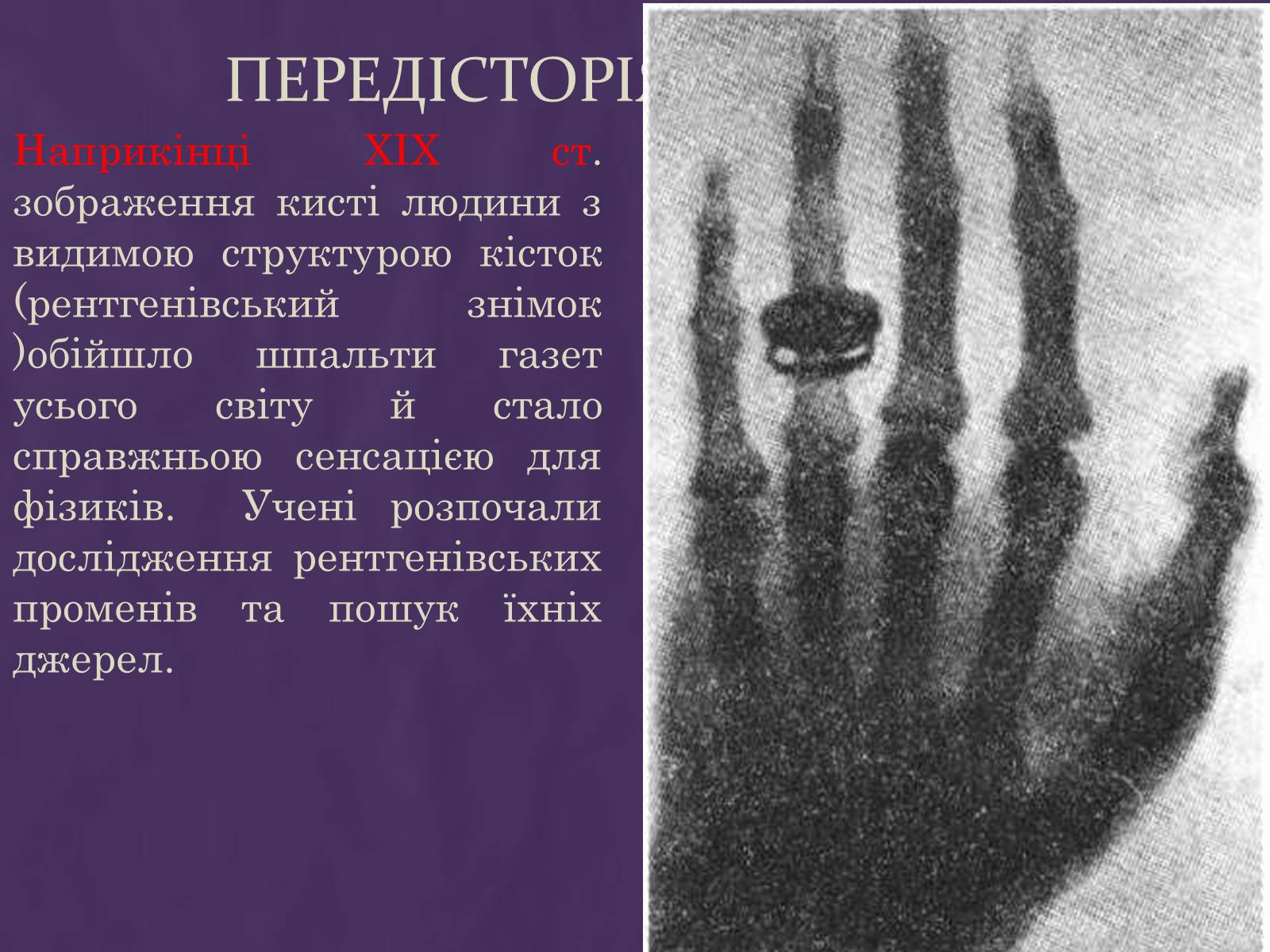 Презентація на тему «Вплив радіоактивного випромінювання на живі організми» (варіант 1) - Слайд #4