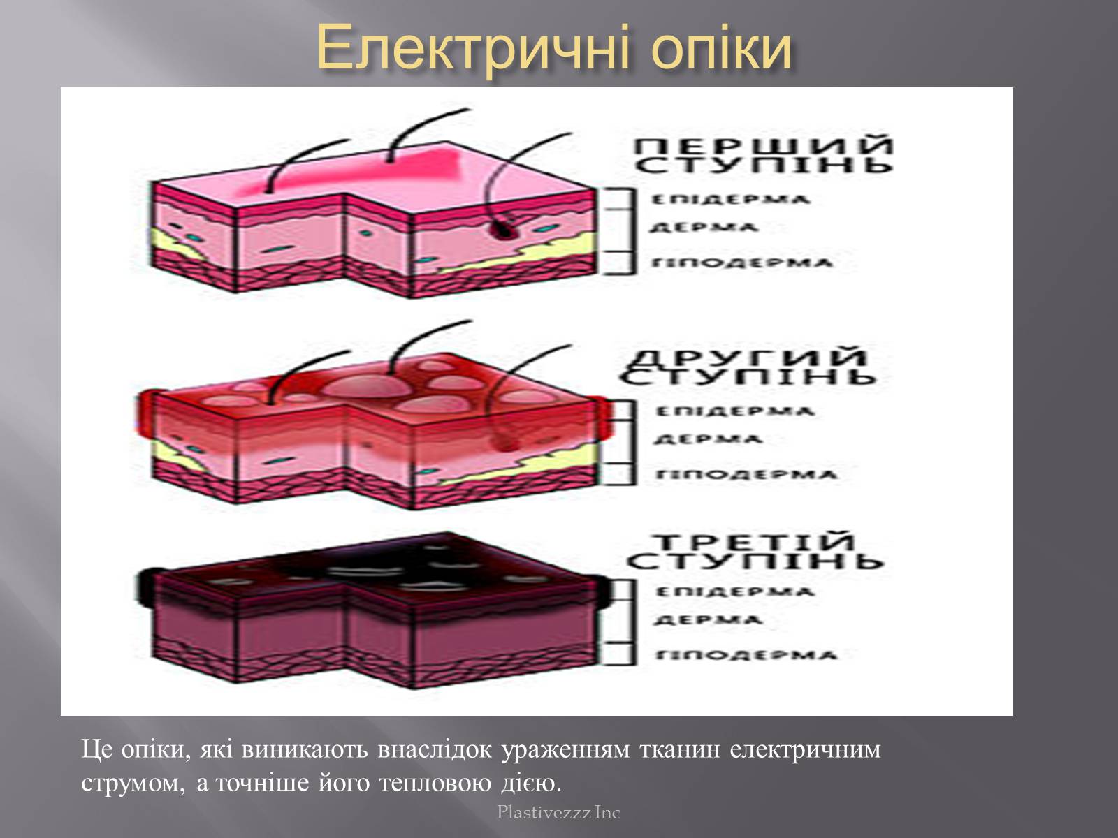 Презентація на тему «Безпека при роботі з електричним струмом» - Слайд #5