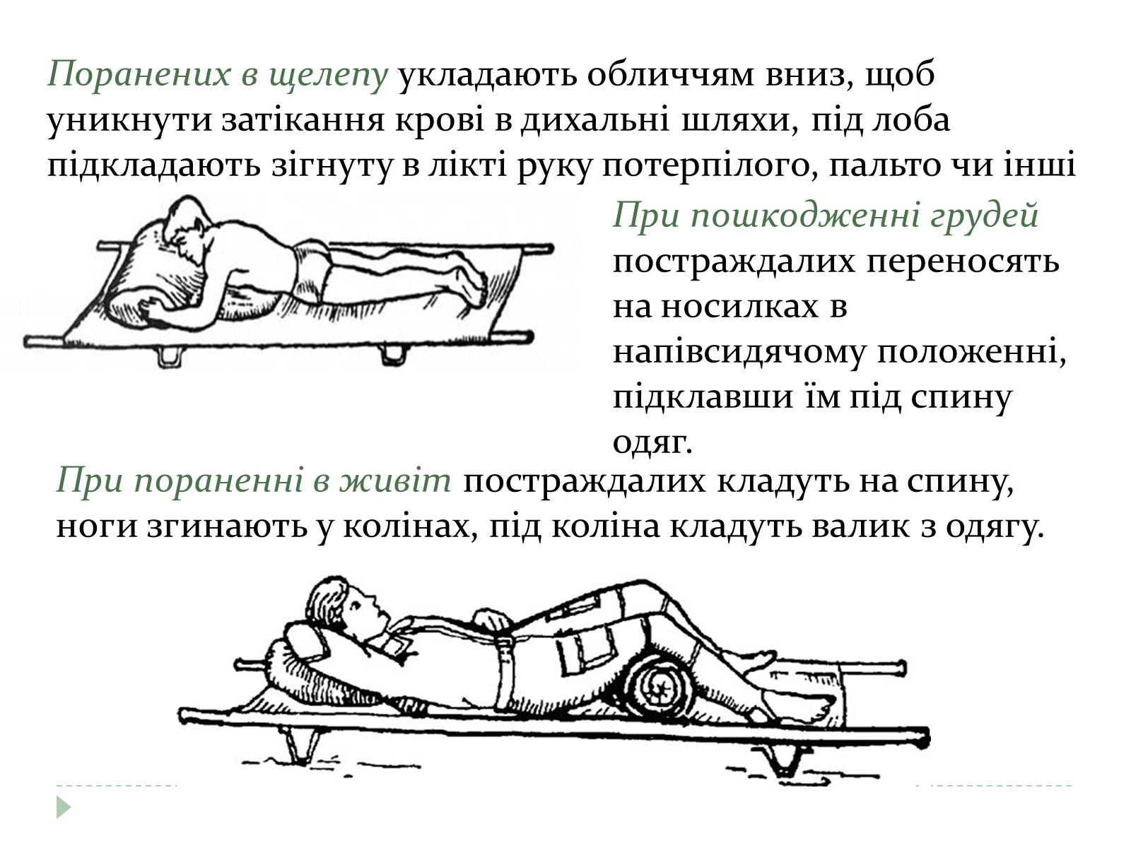 Презентація на тему «Перенесення і транспортування потерпілого» - Слайд #5