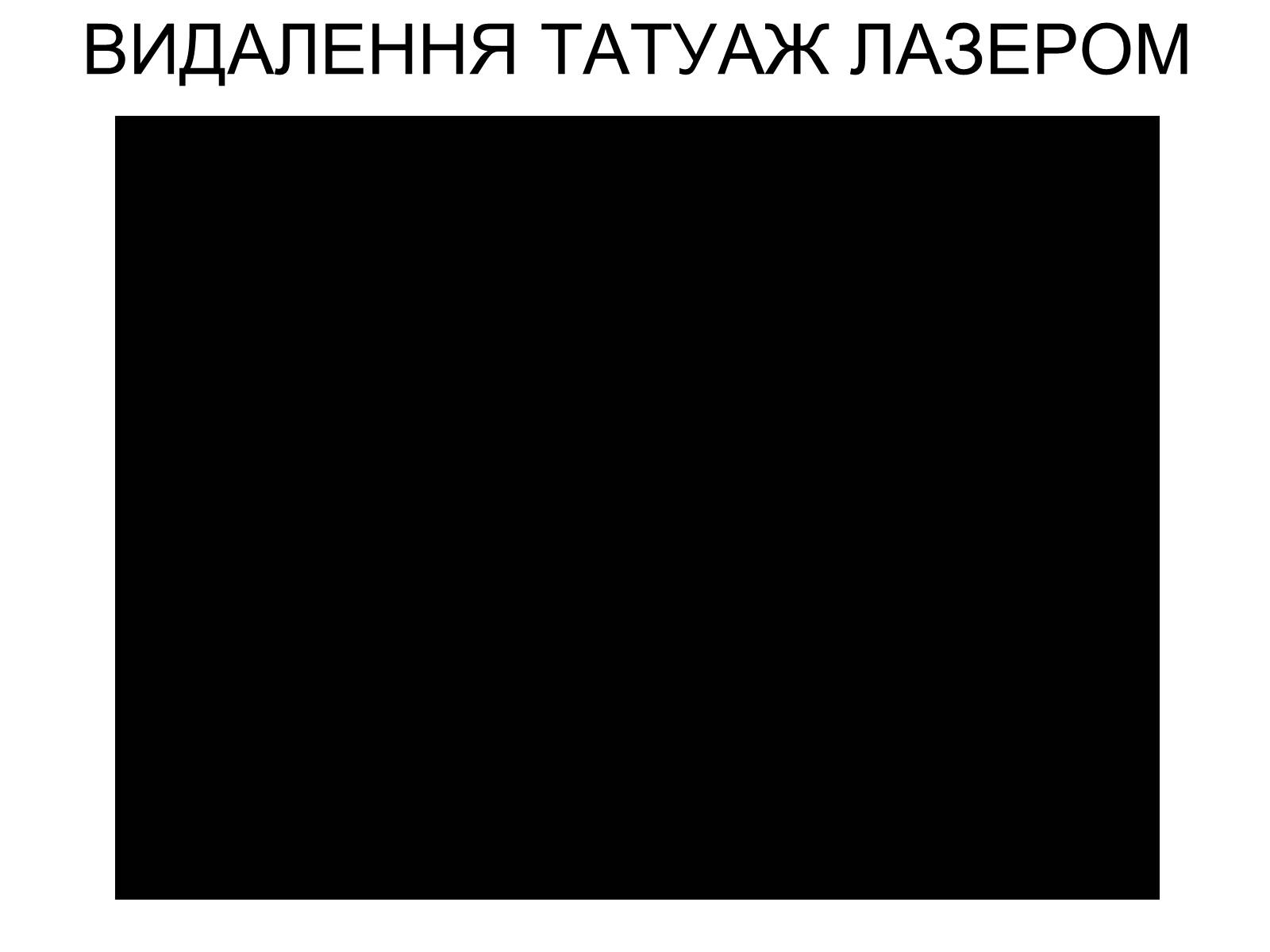 Презентація на тему «Лазери та їх застосування» (варіант 1) - Слайд #12