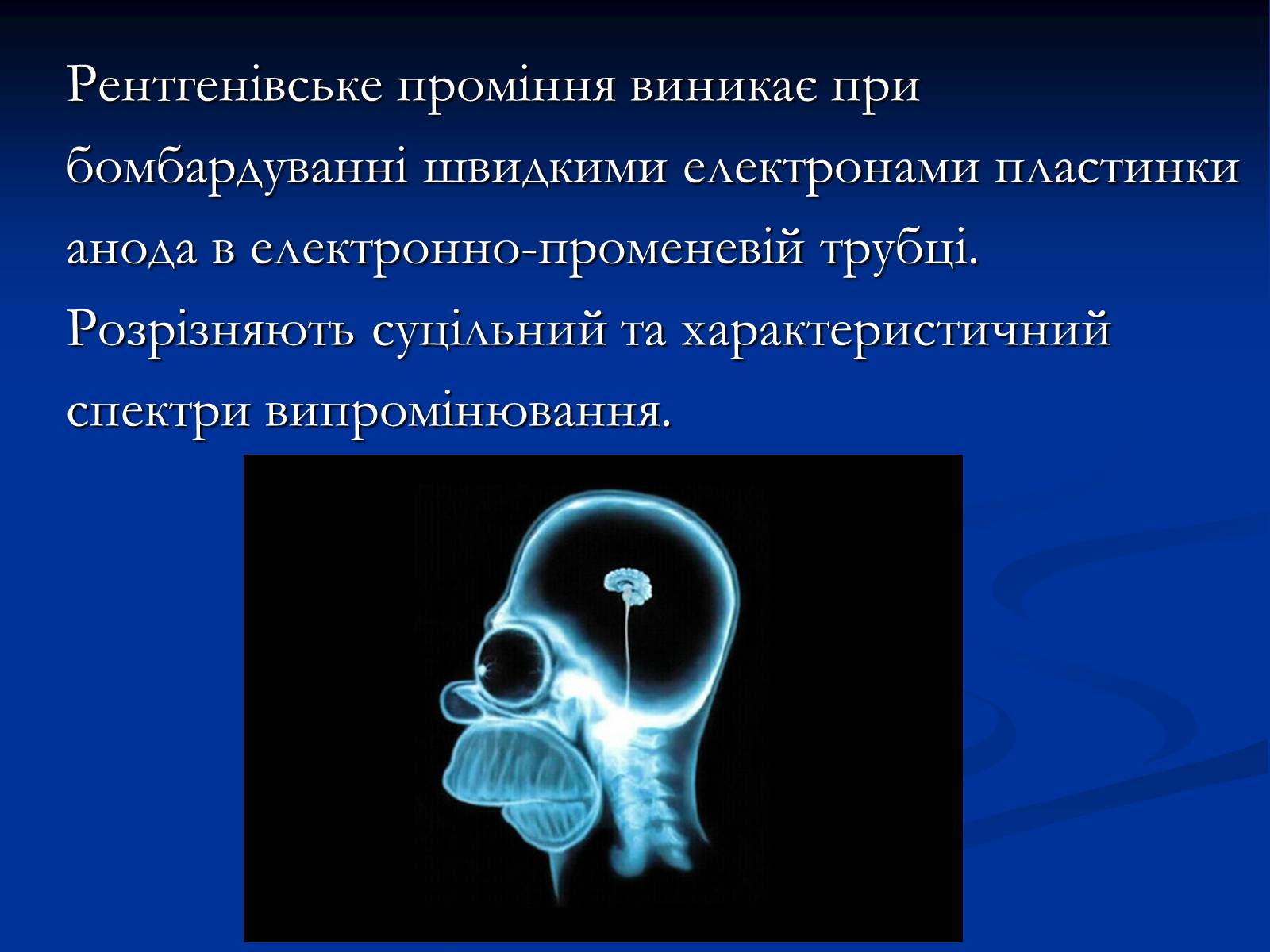 Презентація на тему «Рентгенівське випромінювання» (варіант 3) - Слайд #8