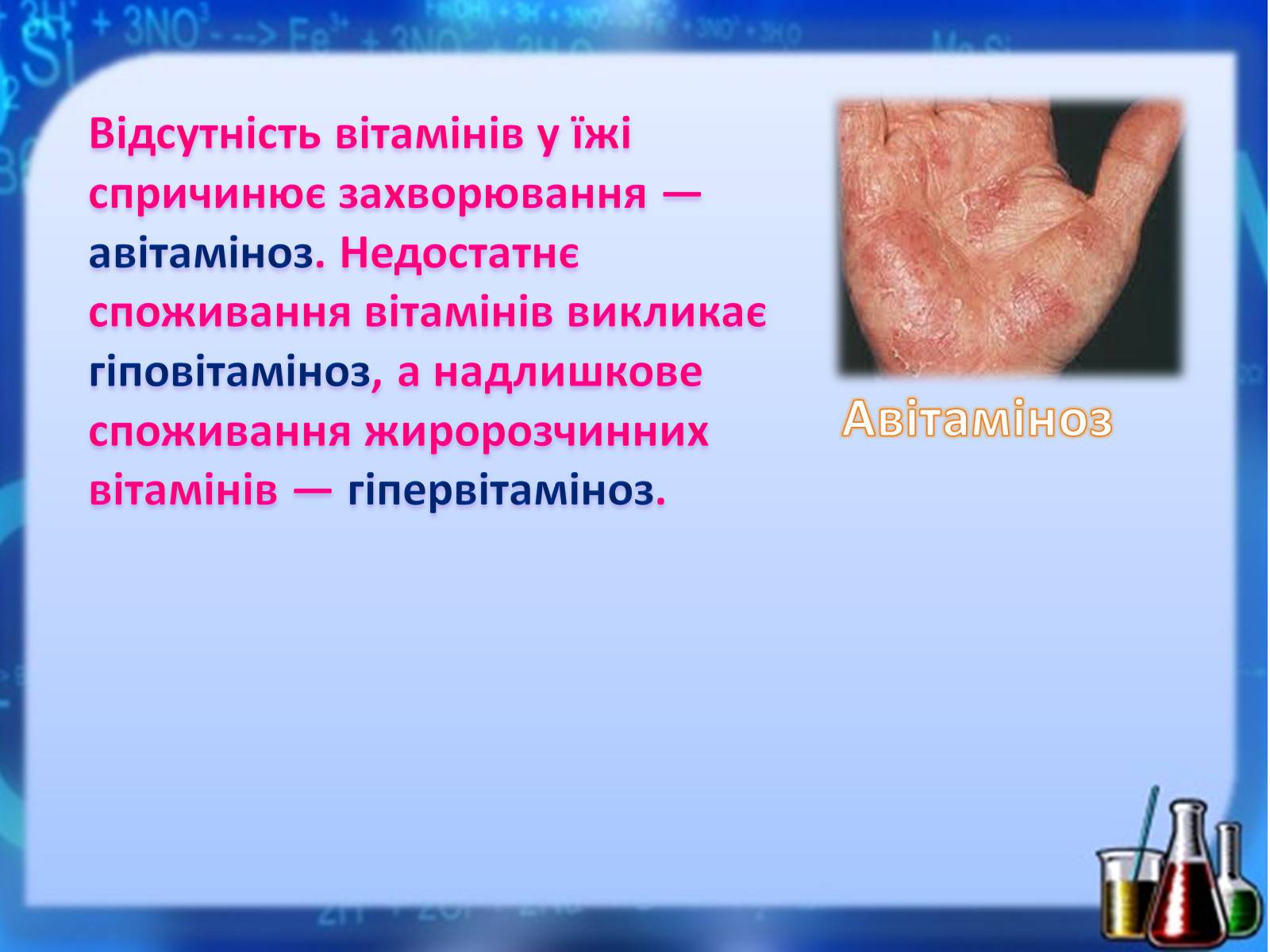 Презентація на тему «Жири, вуглеводи, білки, вітаміни як компоненти їжі» (варіант 1) - Слайд #36