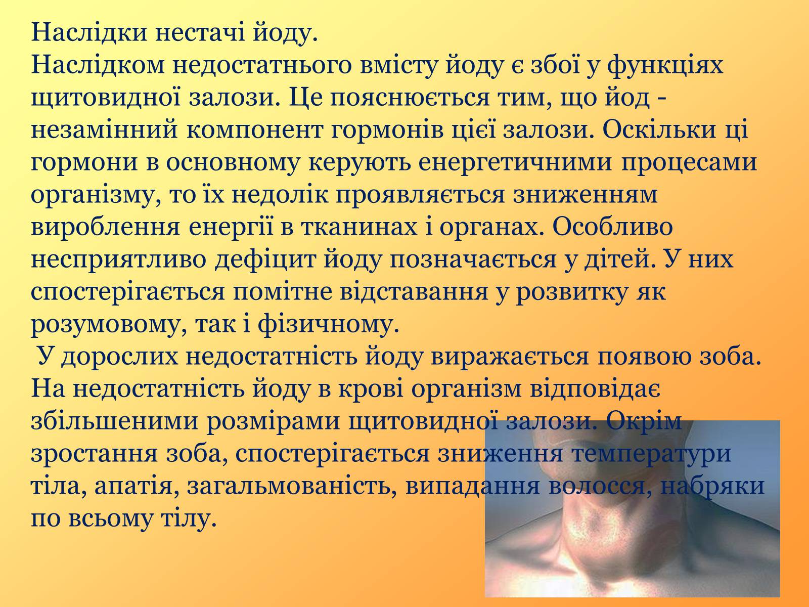 Презентація на тему «Раціональне харчування» (варіант 1) - Слайд #14