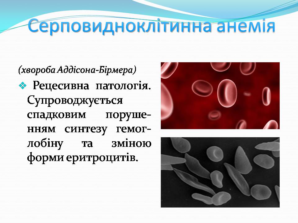 Презентація на тему «Генетичні захворювання» (варіант 2) - Слайд #8