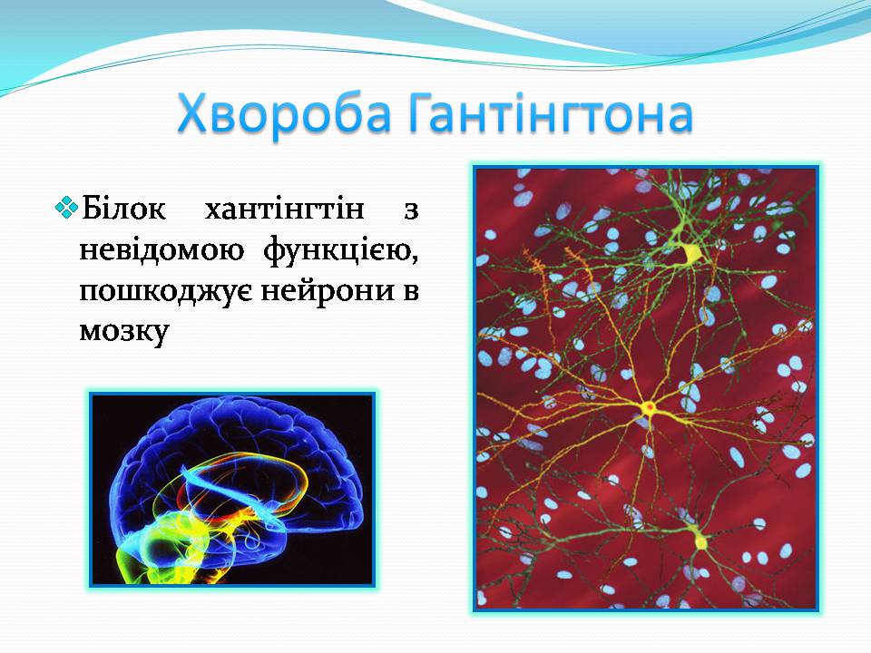 Презентація на тему «Генетичні захворювання» (варіант 2) - Слайд #9