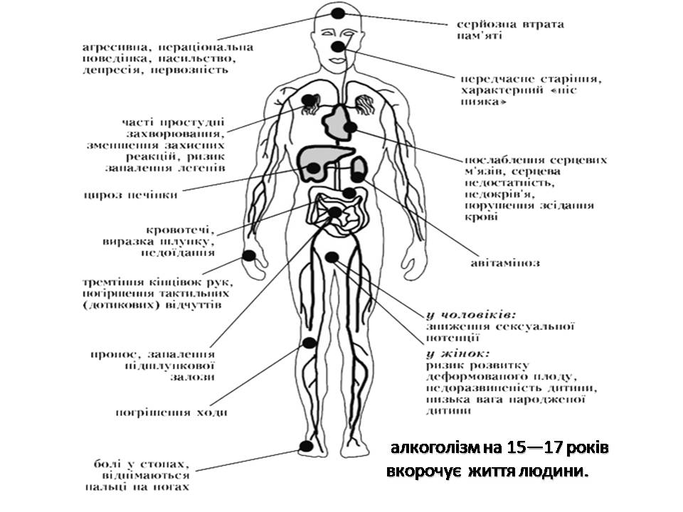 Презентація на тему «Шкідливий вплив алкоголю на організм людини» - Слайд #6