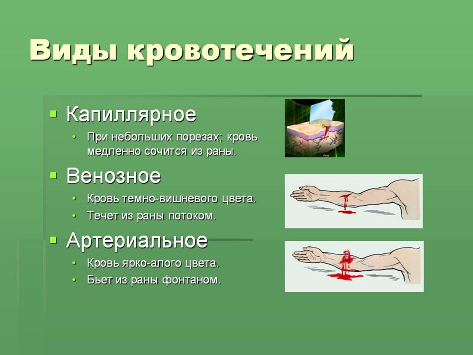 Презентація на тему «Кровоносна система» (варіант 1) - Слайд #24