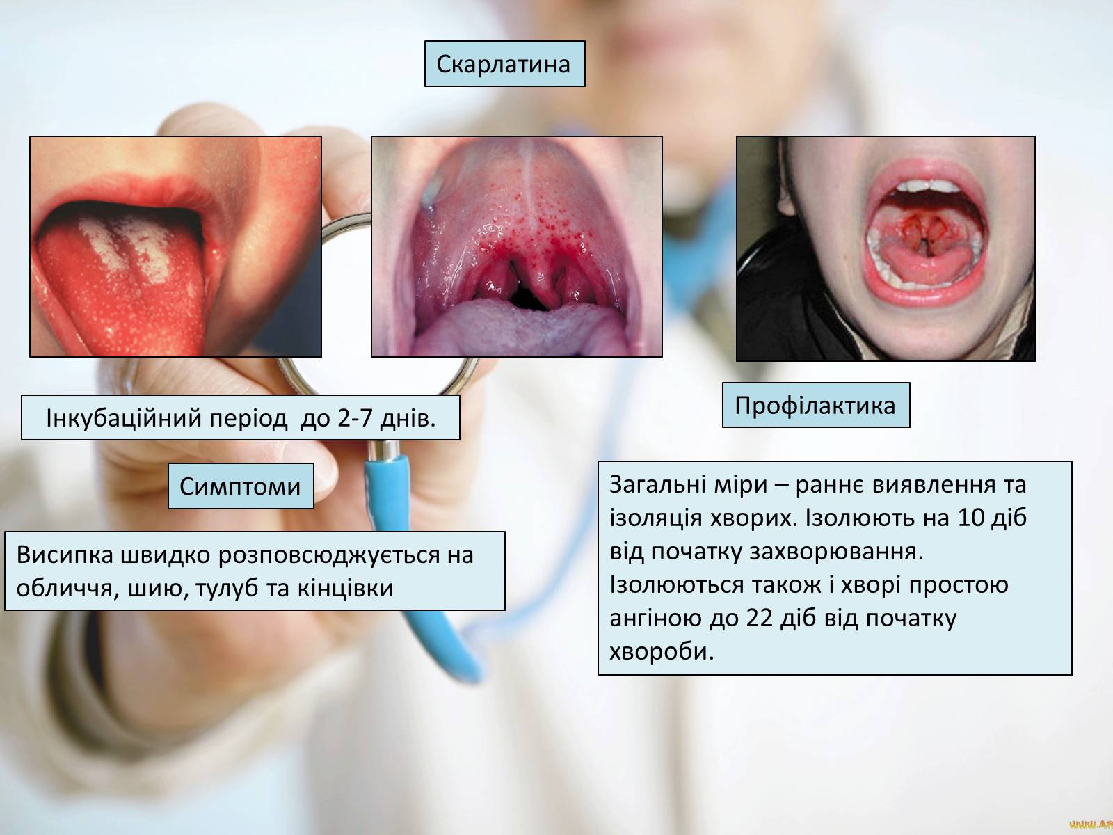 Презентація на тему «Профілактика інфекційних захворювань» (варіант 6) - Слайд #5