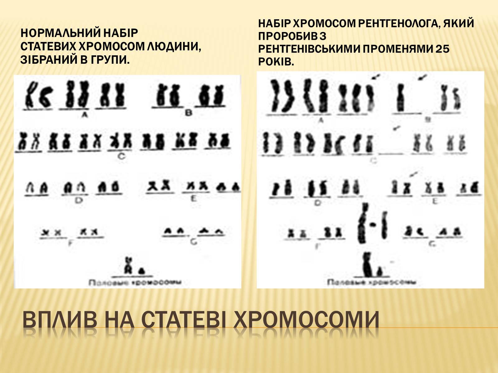 Презентація на тему «Вплив радіоактивного випромінюваня на організм людини» (варіант 1) - Слайд #10