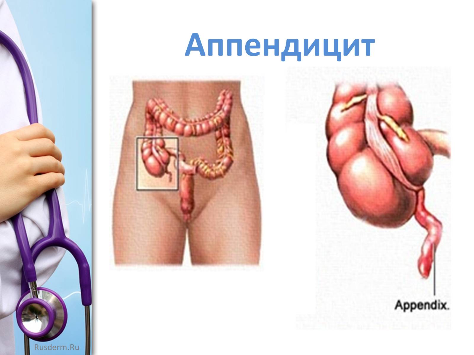 Презентація на тему «Заболевания пищеварительной системы» - Слайд #29