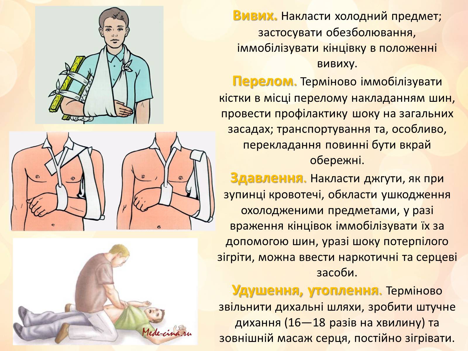 Презентація на тему «Перша медична допомога» (варіант 3) - Слайд #10