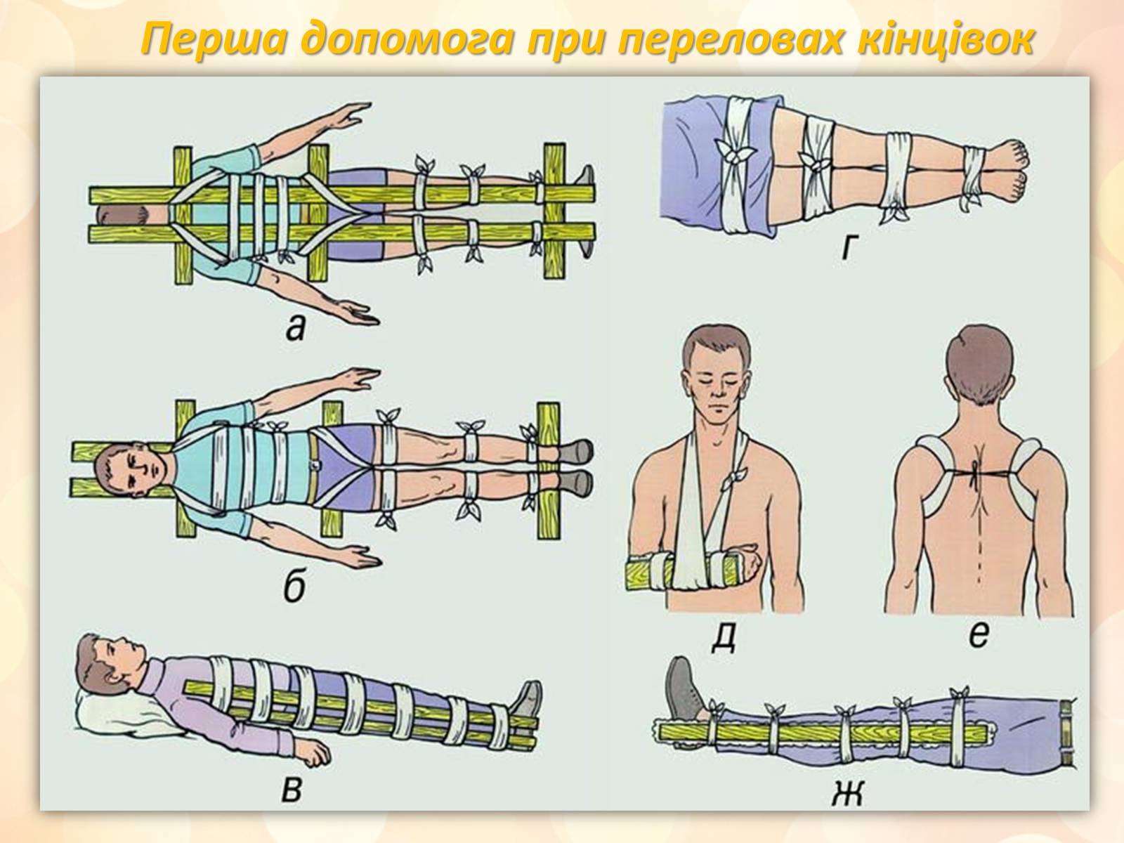 Презентація на тему «Перша медична допомога» (варіант 3) - Слайд #11