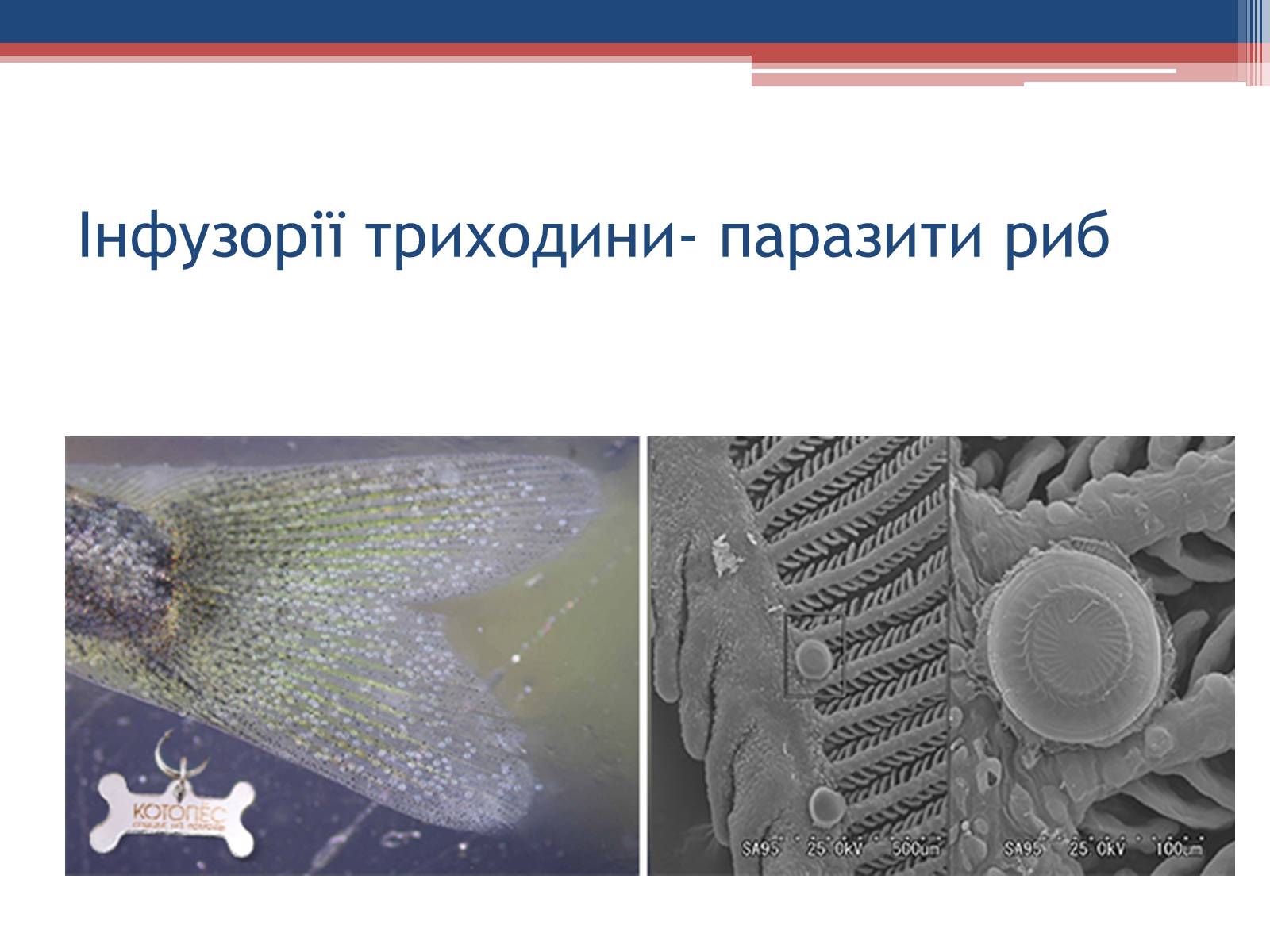 Презентація на тему «Хвороби людини, що викликаються одноклітинними тваринами» - Слайд #25