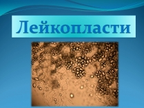 Презентація на тему «Лейкопласти»