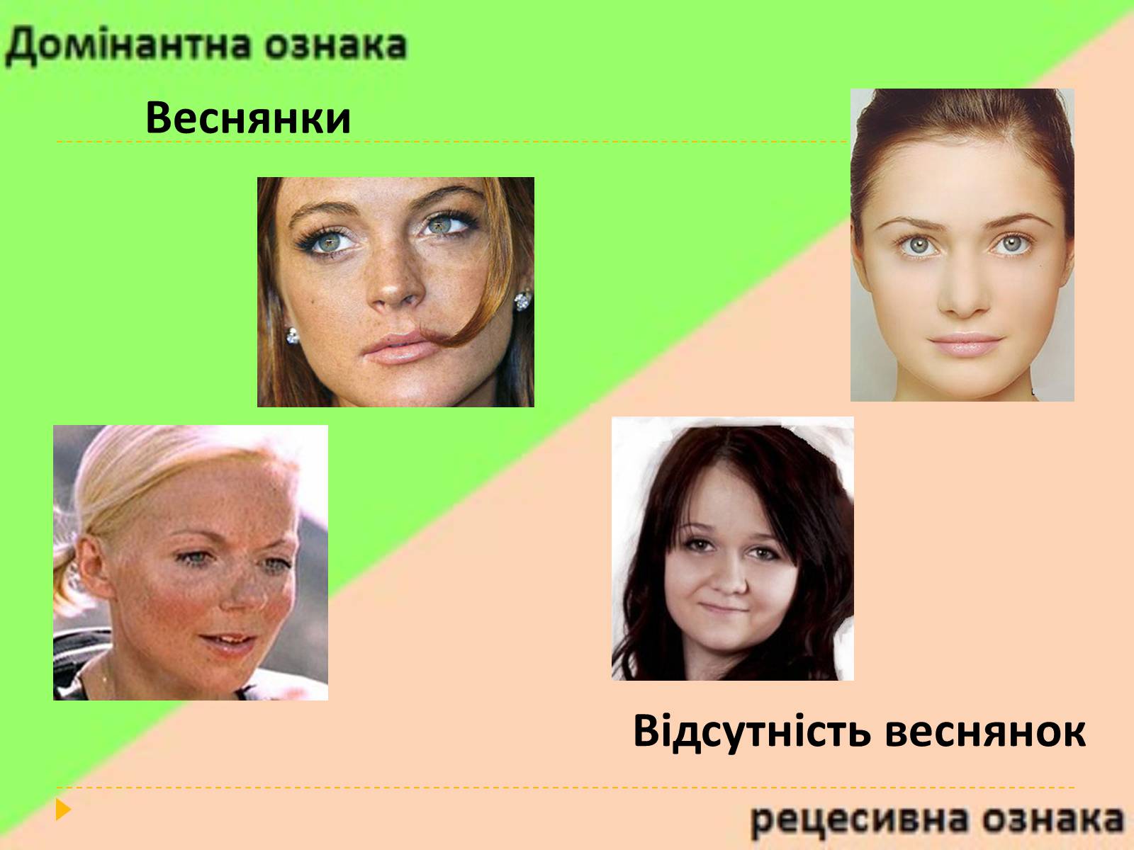 Презентація на тему «Домінантні та рецесивні стани ознак у людини» - Слайд #14