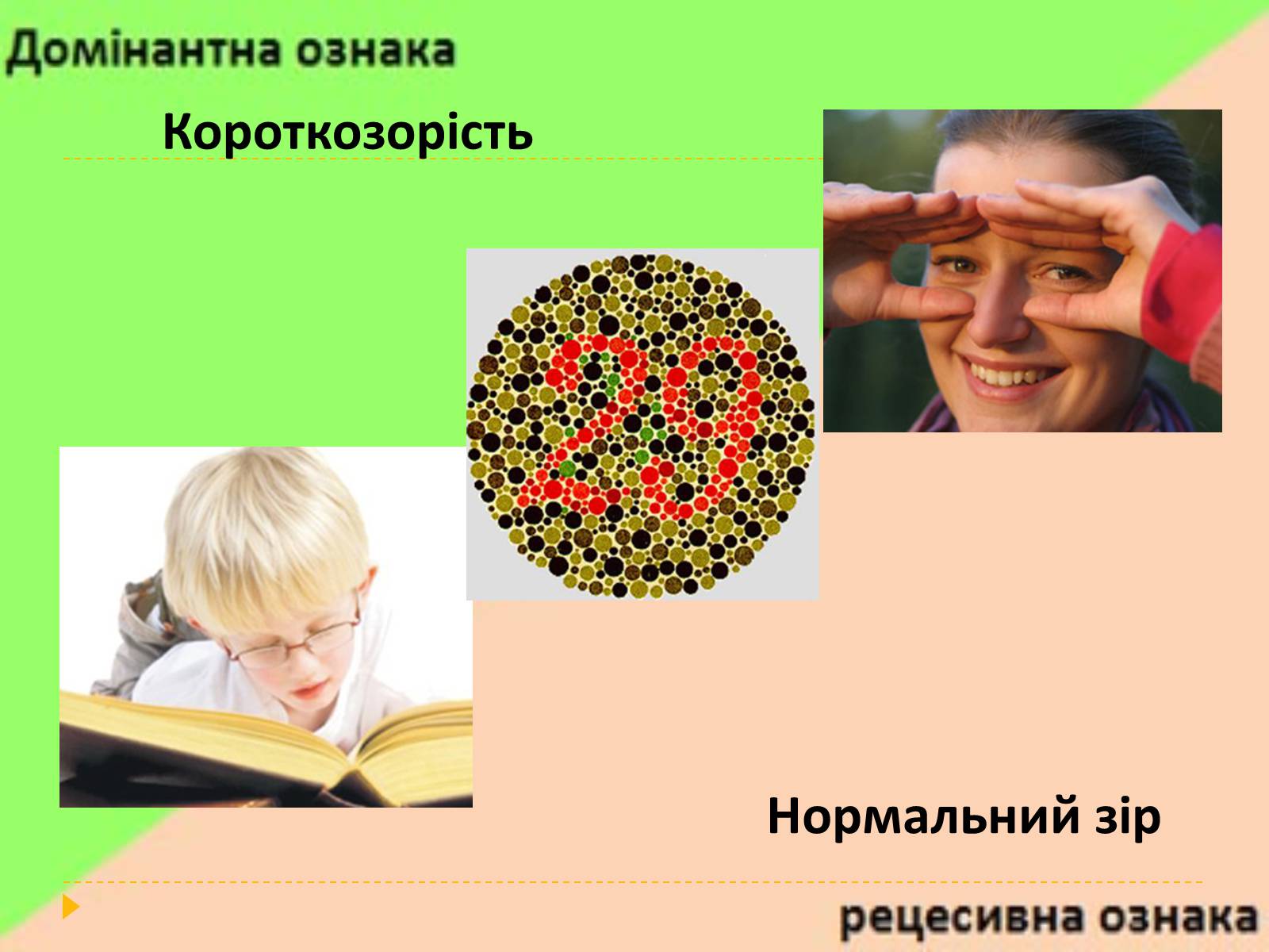 Презентація на тему «Домінантні та рецесивні стани ознак у людини» - Слайд #7