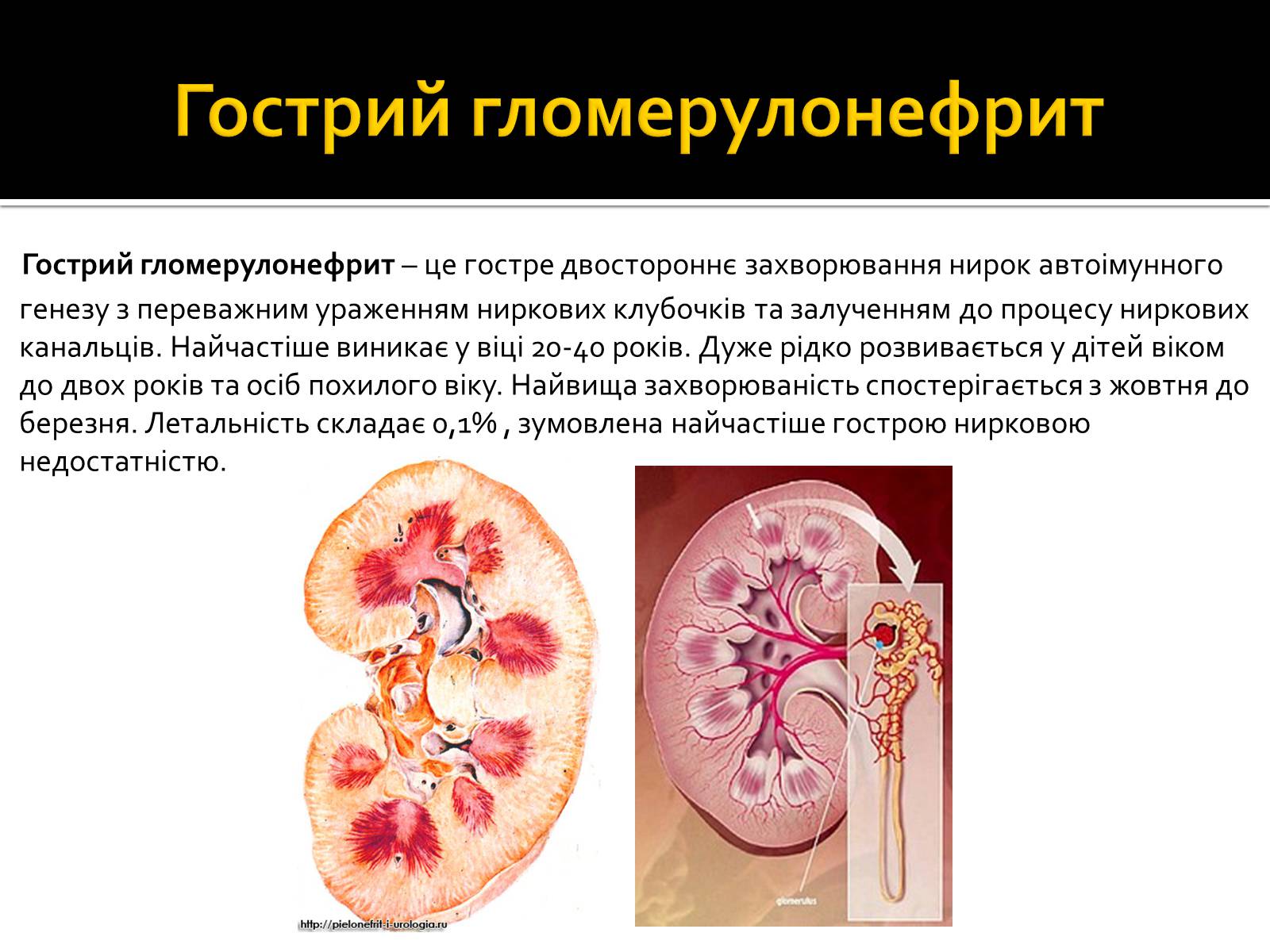 Презентація на тему «Захворювання нирок та сечовивідних шляхів» - Слайд #2