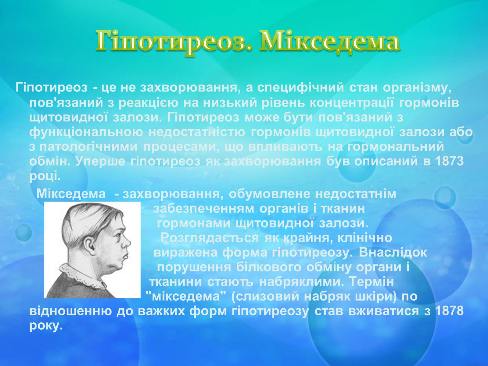 Презентація на тему «Щитоподібна залоза» - Слайд #6