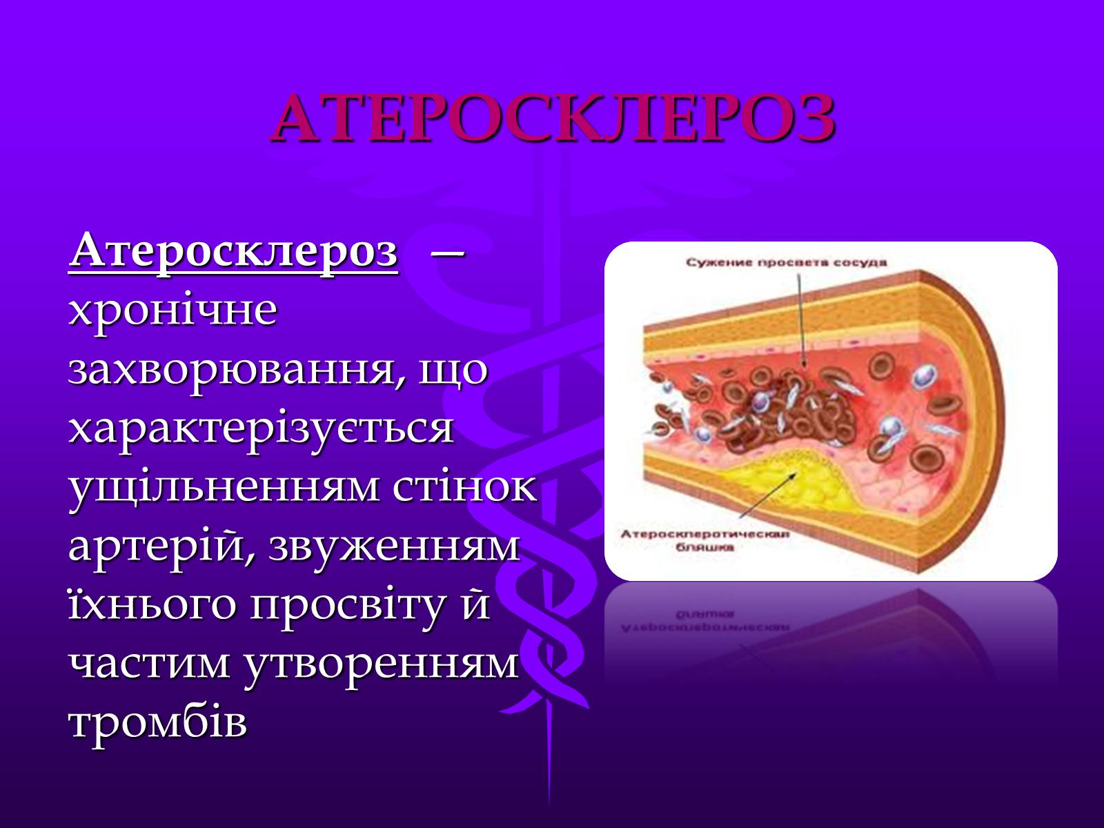 Презентація на тему «Хвороби серцево-судинної системи» (варіант 3) - Слайд #16