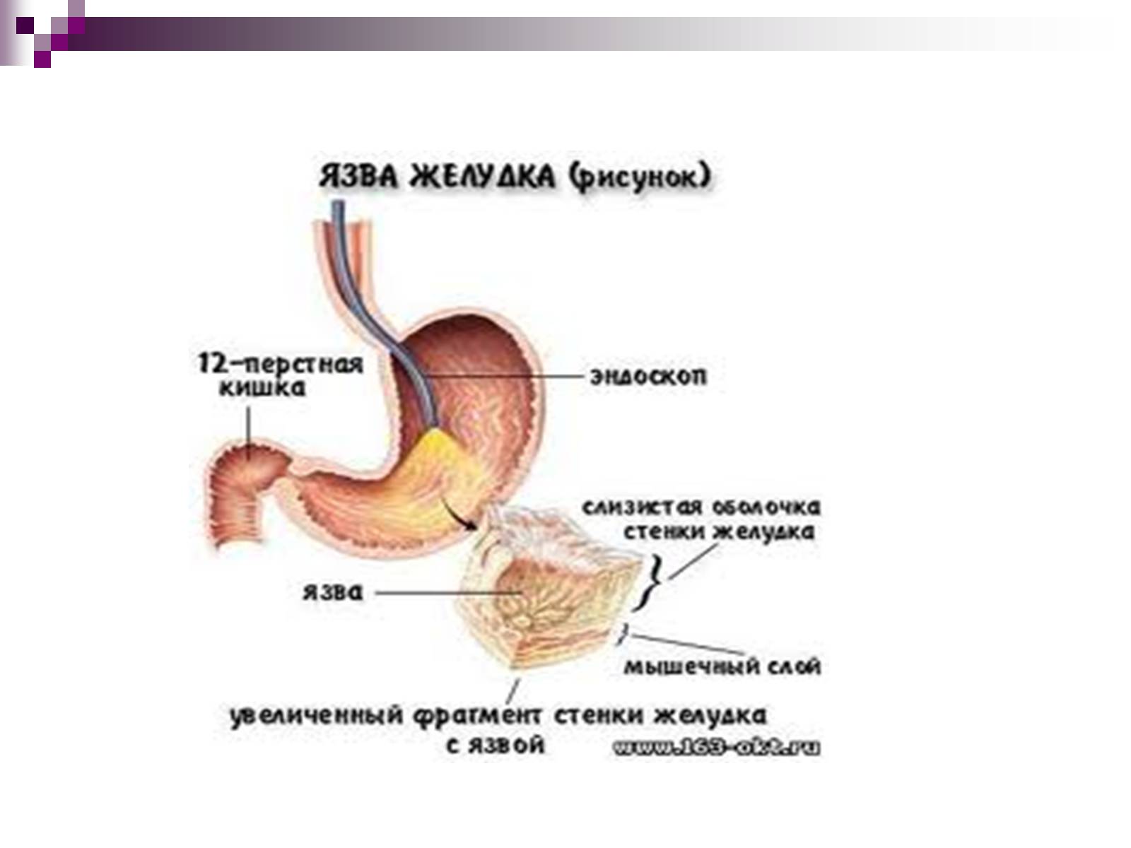 Презентація на тему «Вплив спиртів на організм людини» - Слайд #7