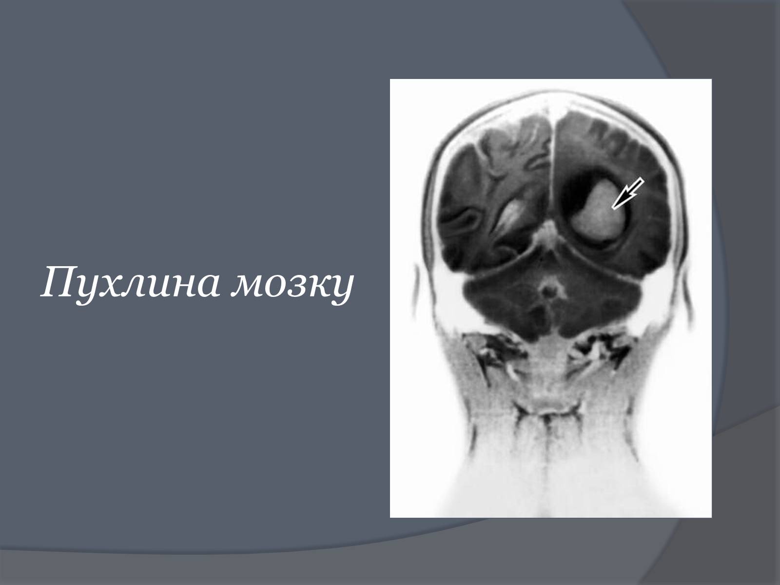 Презентація на тему «Вплив Мобільного телефону на здоров&#8217;я людини» - Слайд #31