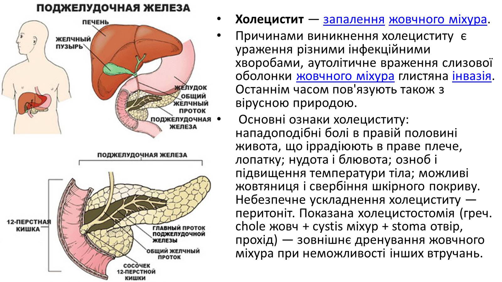 Презентація на тему «Хвороби органів травлення» - Слайд #8