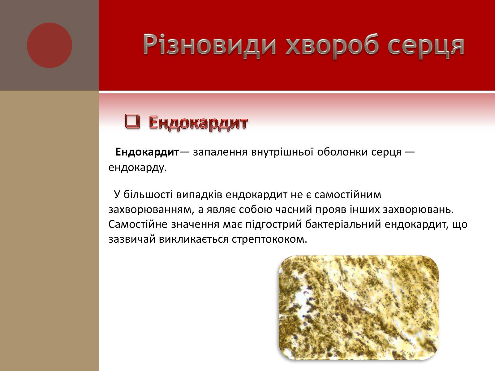 Презентація на тему «Захворювання серцево-судинної системи» (варіант 1) - Слайд #9