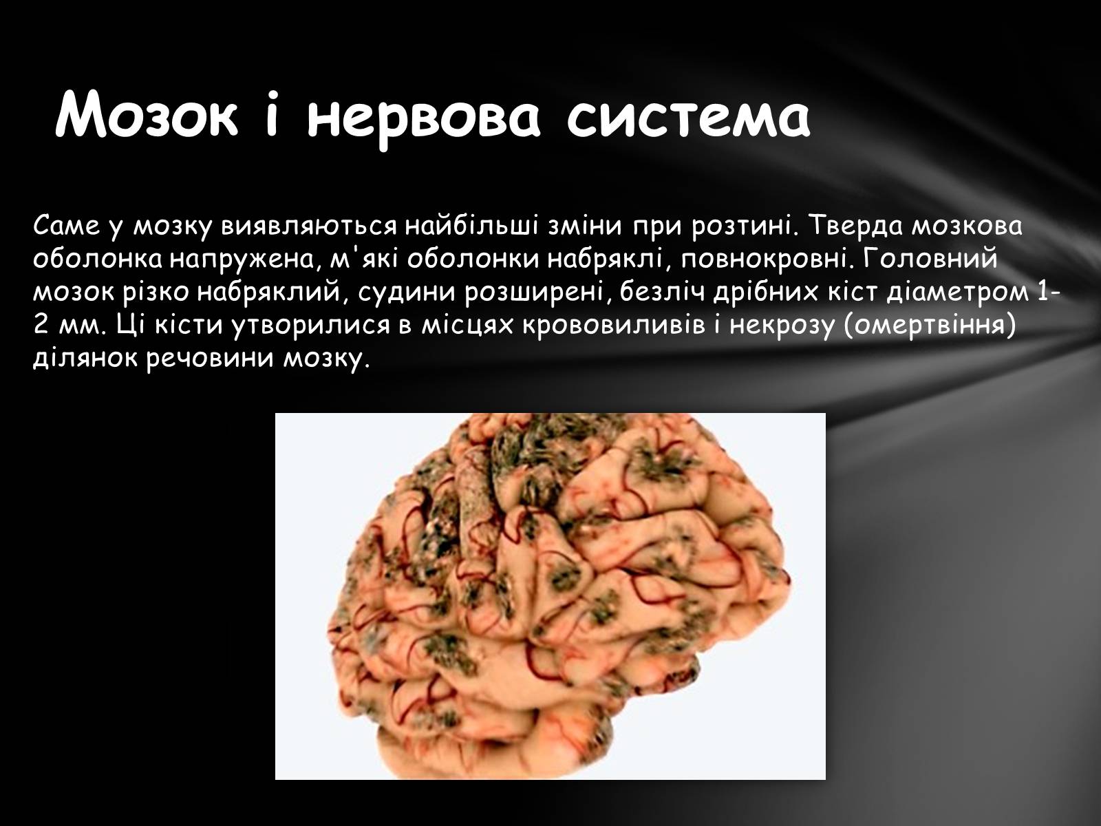 Презентація на тему «Шкідливий вплив алкоголю на організм» - Слайд #14