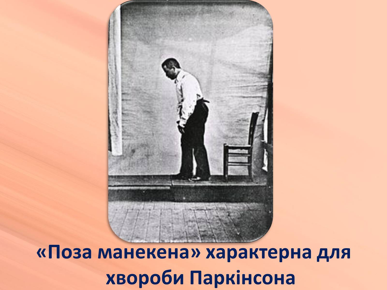 Презентація на тему «Хвороби нервової системи» (варіант 1) - Слайд #9