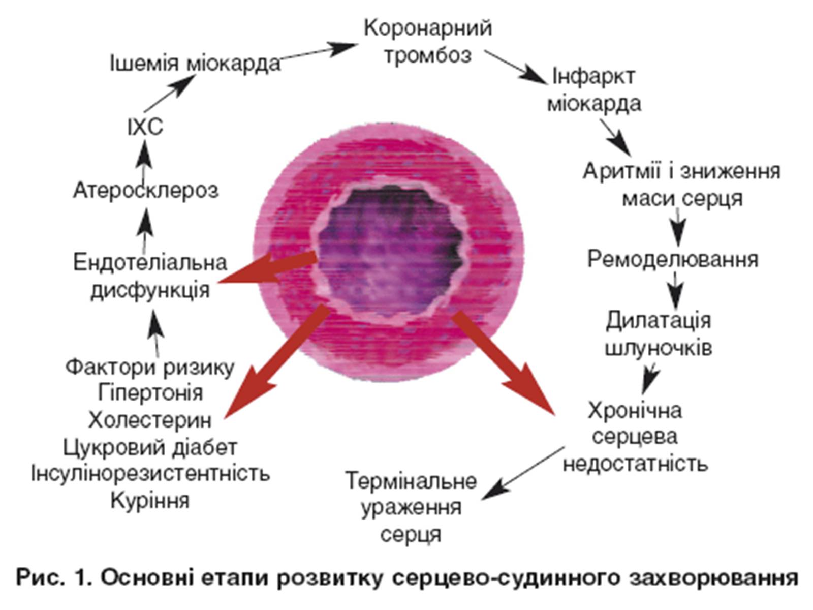 Презентація на тему «Захворювання серцево-судинної системи» (варіант 3) - Слайд #12