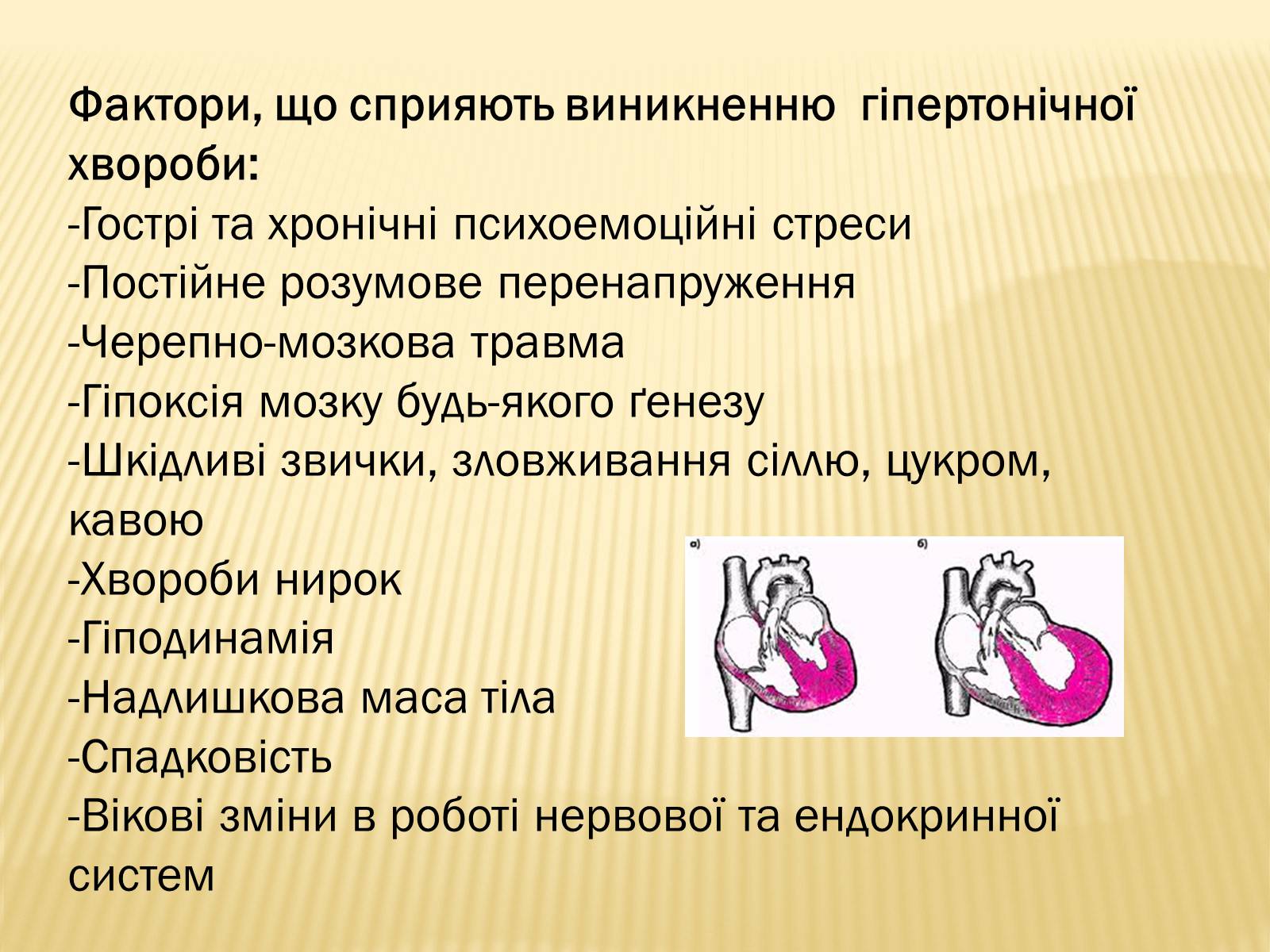 Презентація на тему «Захворювання серцево-судинної системи» (варіант 3) - Слайд #7