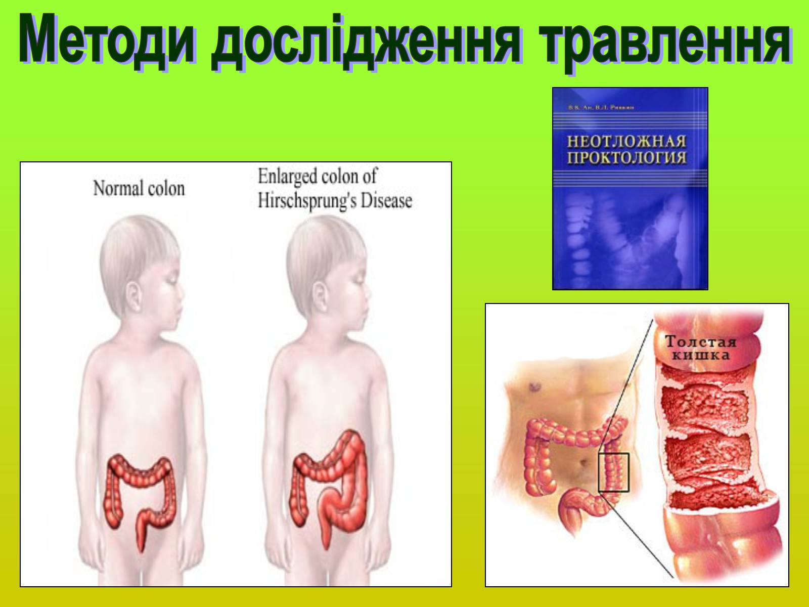 Презентація на тему «Методи дослідження органів травлення» - Слайд #16