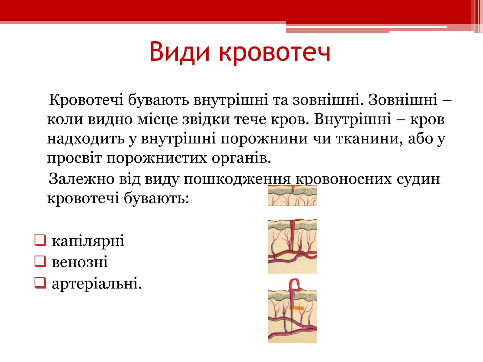 Презентація на тему «Перша допомога при кровотечах» (варіант 1) - Слайд #4