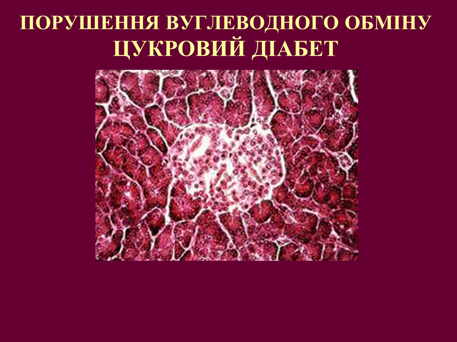 Презентація на тему «Цукровий діабет» - Слайд #1