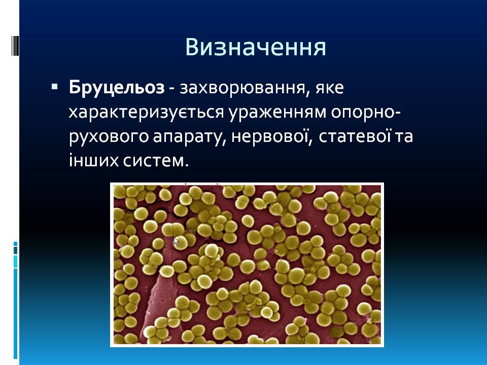 Презентація на тему «Бруцельоз» - Слайд #2