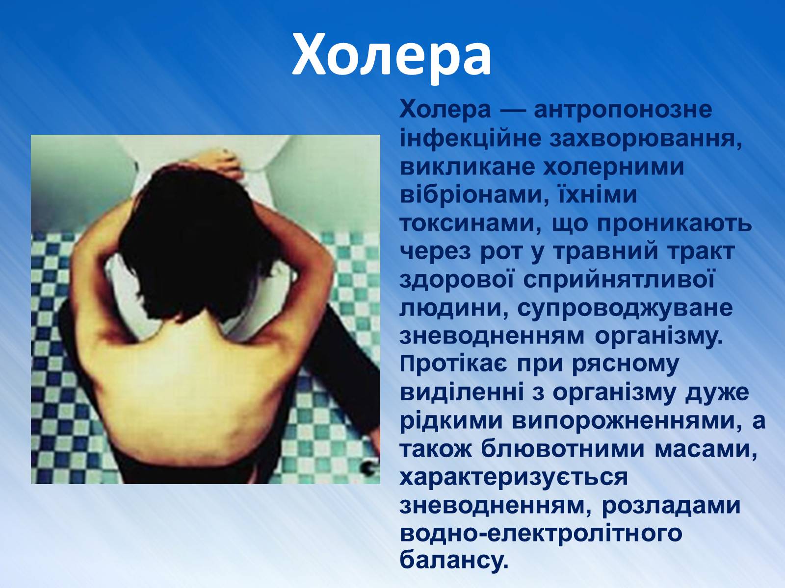 Презентація на тему «Захворювання травної системи» (варіант 1) - Слайд #12