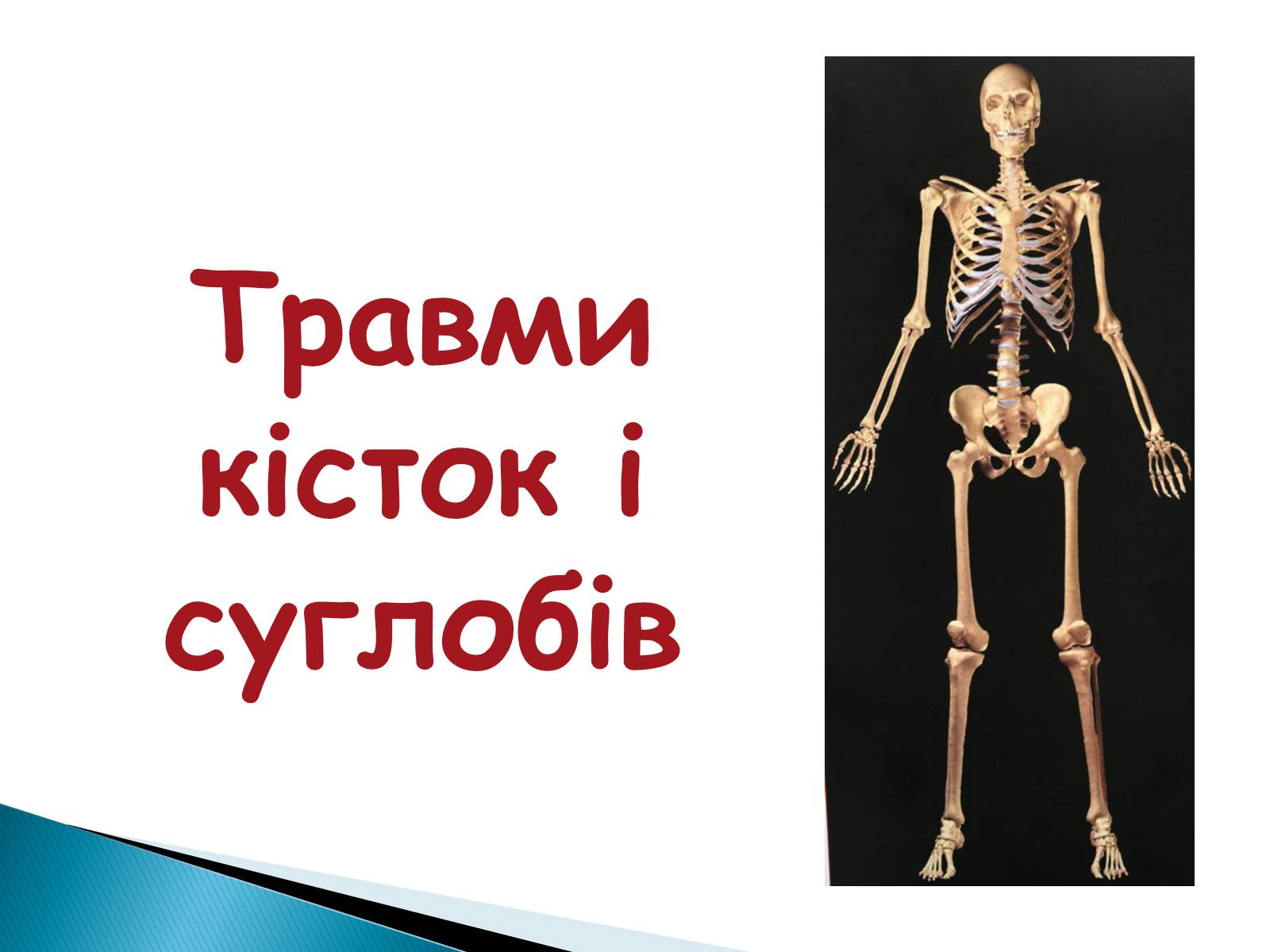 Презентація на тему «Травма систем організму» (варіант 2) - Слайд #8