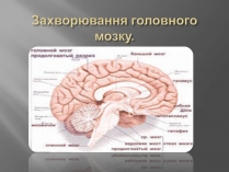 Презентація на тему «Захворювання головного мозку»