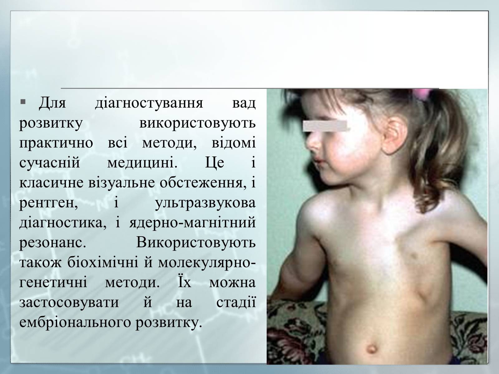 Презентація на тему «Діагностування вад розвитку людини та їх корегування» - Слайд #11