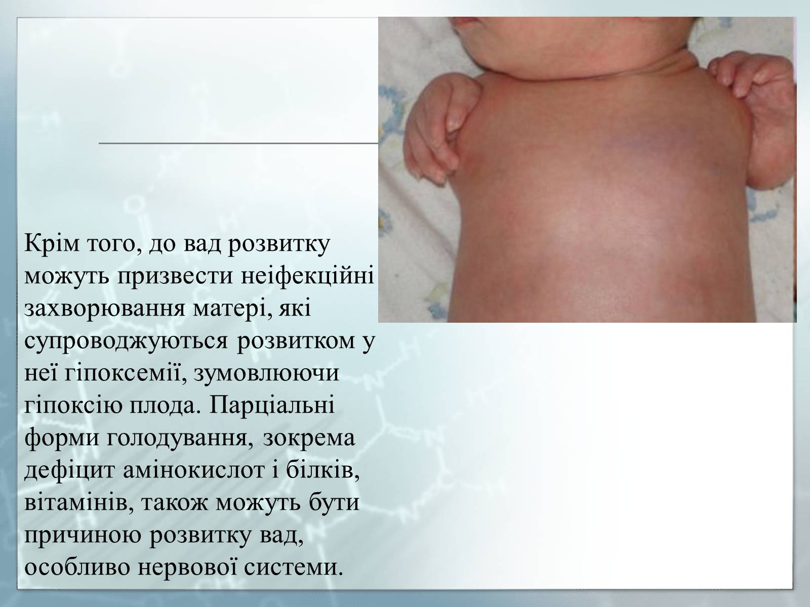 Презентація на тему «Діагностування вад розвитку людини та їх корегування» - Слайд #15