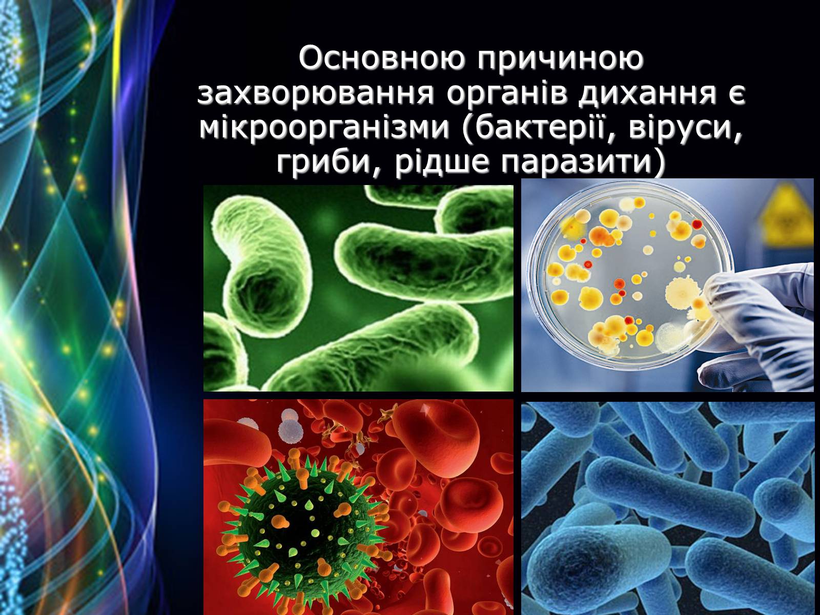 Презентація на тему «Захворювання дихальної системи» (варіант 2) - Слайд #3