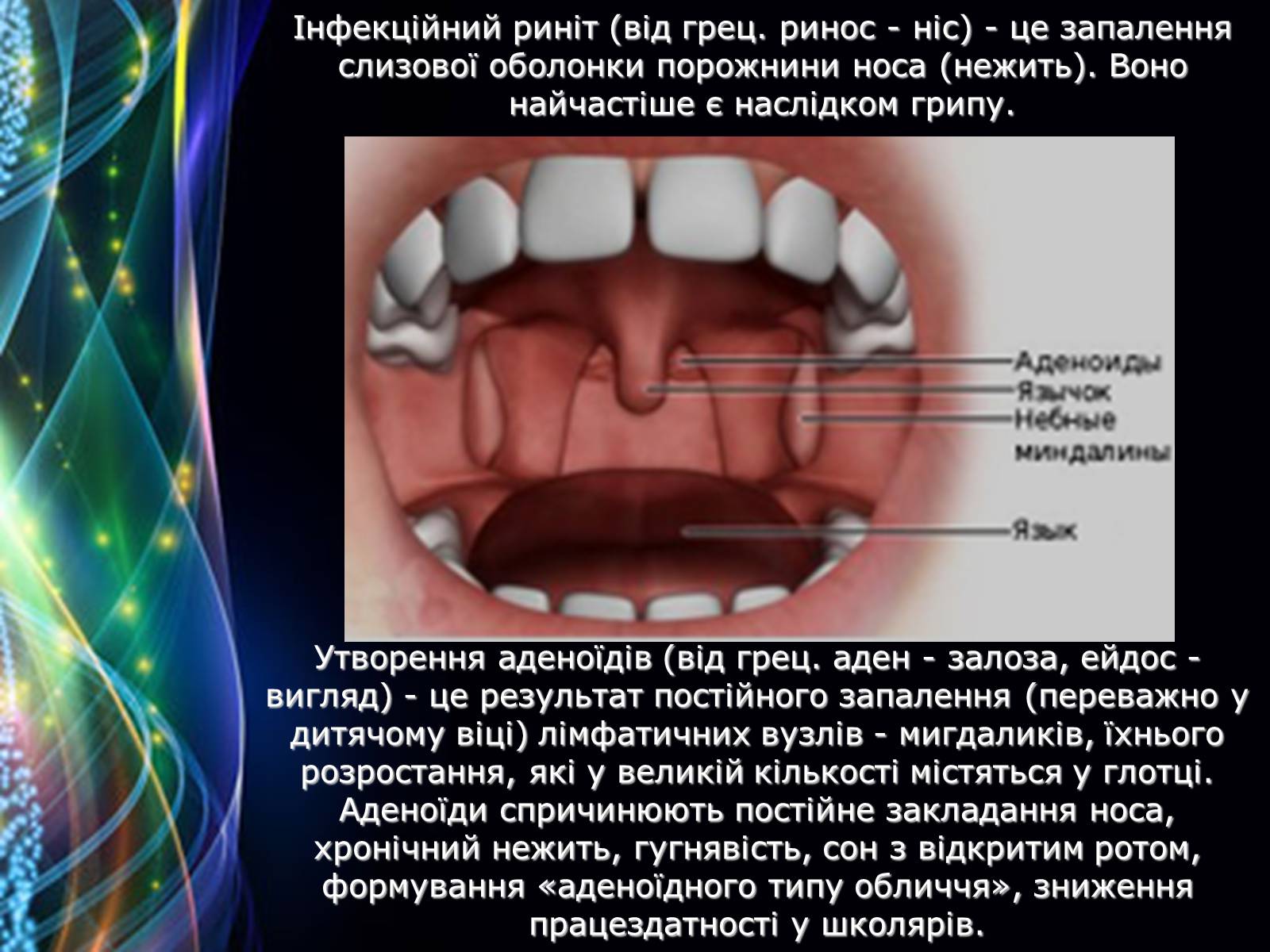 Презентація на тему «Захворювання дихальної системи» (варіант 2) - Слайд #7