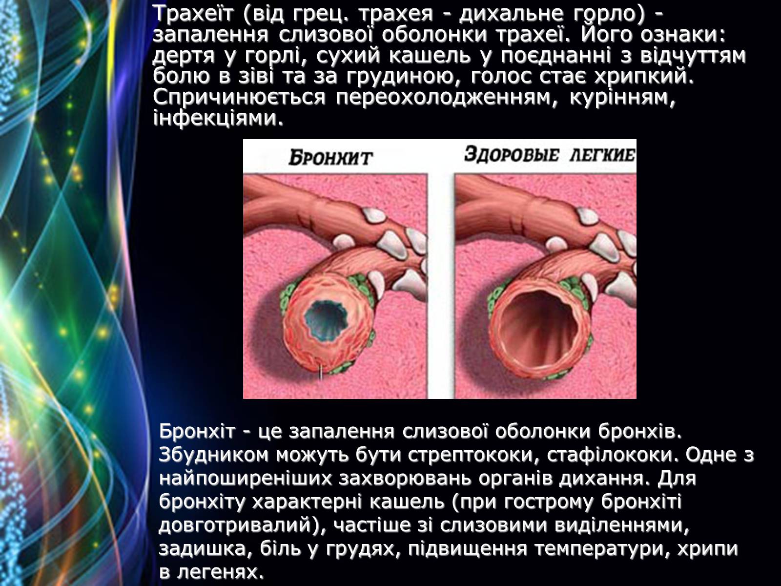 Презентація на тему «Захворювання дихальної системи» (варіант 2) - Слайд #9