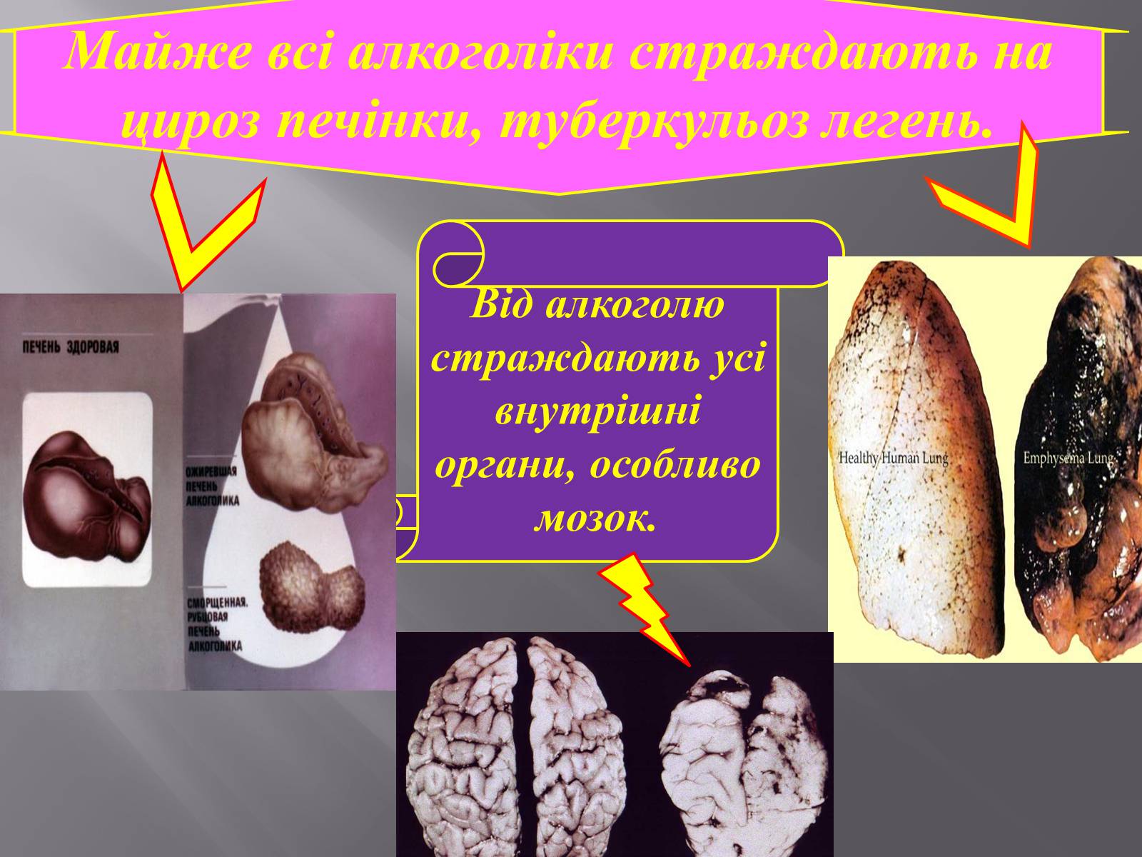 Презентація на тему «Вплив куріння, алкоголю та наркотиків на здоров&#8217;я» - Слайд #12