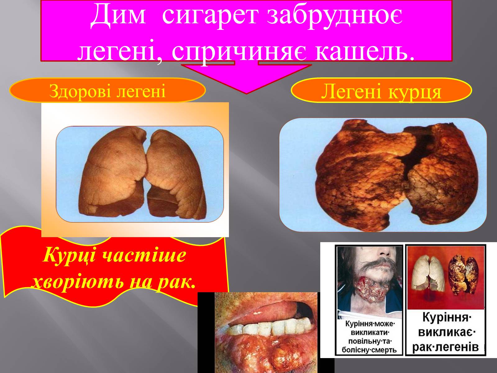 Презентація на тему «Вплив куріння, алкоголю та наркотиків на здоров&#8217;я» - Слайд #5